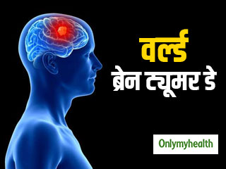 World Brain Tumor Day 2021: कैसे होती है ब्रेन ट्यूमर की शुरूआत? एक्‍सपर्ट से जानें इससे जुड़ी सभी बातें 