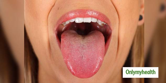 Here’s What the Colour of Your Tongue Reveals About Your Health ...