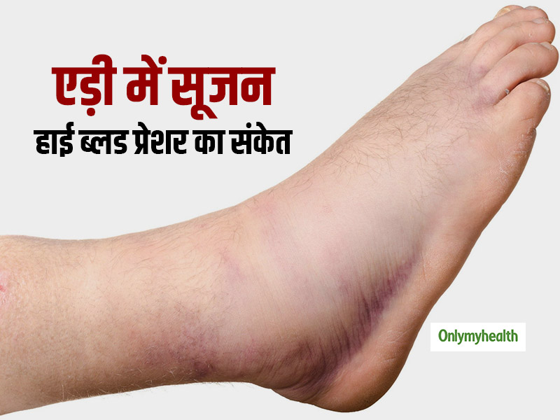 swollen-ankles-can-be-sign-of-high-blood-pressure-know-the-risk-factors