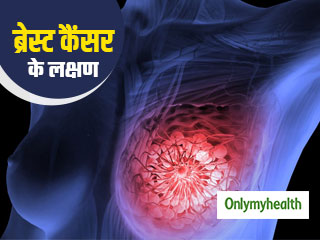 महिलाओं में ब्रेस्ट कैंसर के लक्षण क्या होते हैं? जानें इसके जांच और इलाज के तरीके