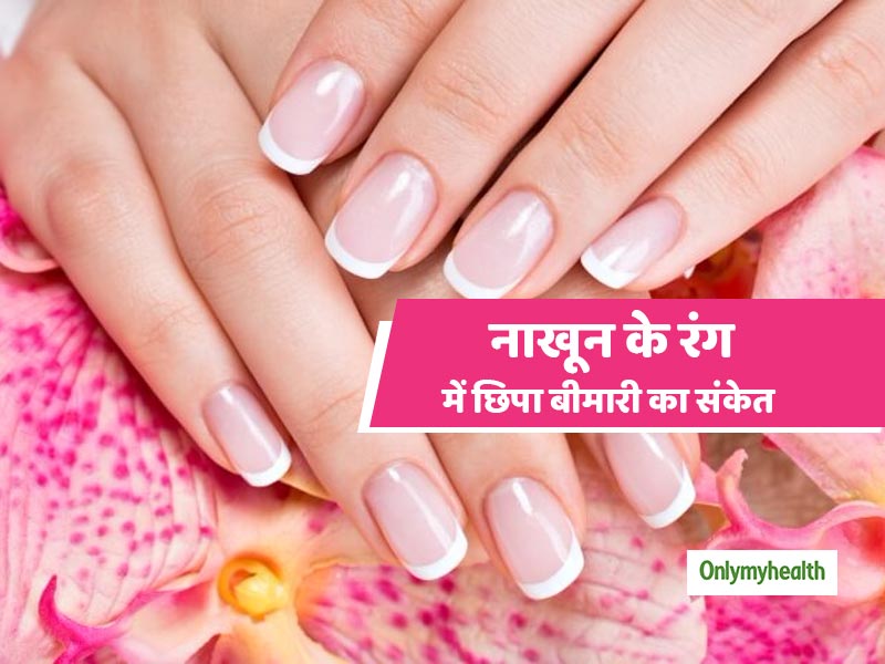 Nails Is Associated With Your Health Read the Signs In Hindi | नाखून बताते  हैं आप कौन सी बीमारी का हैं शिकार, जानें किस रंग के नाखून होते हैं बेहतर
