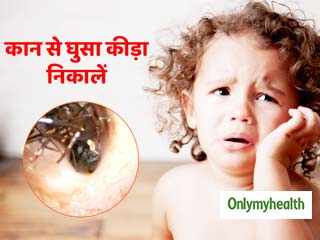 कान में चला गया है कीड़ा तो इन 4 आसान तरीकों से निकालें बाहर, नहीं होगा दर्द