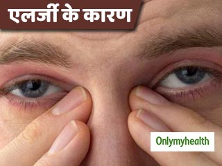कुछ लोग क्यों होते हैं एलर्जी के जल्दी शिकार? जानें इससे बचाव के तरीके