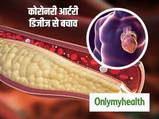 एक्सपर्ट : युवाओं में बढ़ रहे हैं कोरोनरी आर्टरी डिजीज के मामले, जानें बचाव के तरीके