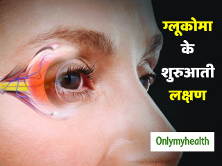 ग्लूकोमा छीन सकता है आपके आंखों की रोशनी, ये 6 लक्षण दिखने पर कराएं आंखों की जांच