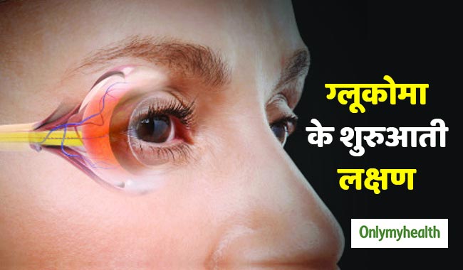 ग्लूकोमा छीन सकता है आपके आंखों की रोशनी, ये 6 लक्षण दिखने पर कराएं आंखों की जांच