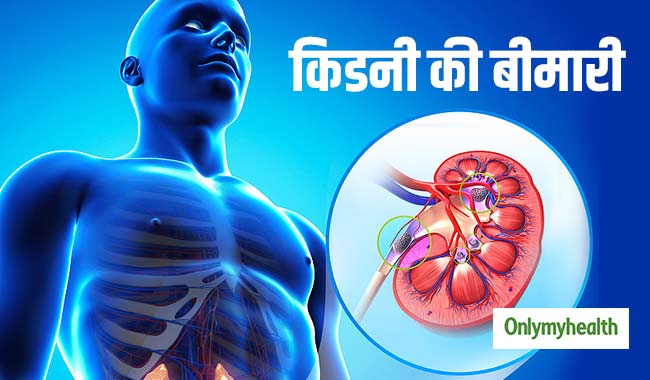 विश्व किडनी दिवस : भारत में हर साल 2 लाख लोगों को होती है किडनी की बीमारी