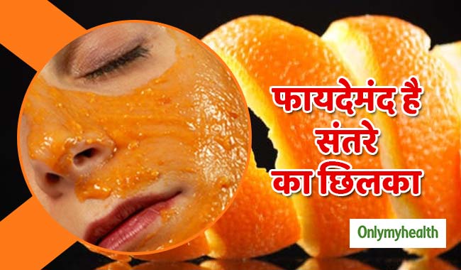 ब्‍लैक हेड्स और मुंहासों को जड़ से खत्‍म करता है संतरे का छिलका, जानें प्रयोग का तरीका