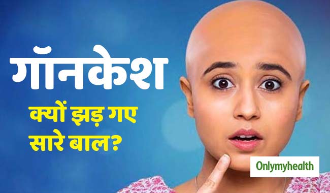 फिल्म 'गॉन-केश' में श्वेता त्रिपाठी हैं 'एलोपेशिया' का शिकार, जानें क्यों झड़ते हैं इस बीमारी में बाल?