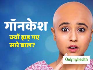 फिल्म 'गॉन-केश' में श्वेता त्रिपाठी हैं 'एलोपेशिया' का शिकार, जानें क्यों झड़ते हैं इस बीमारी में बाल?
