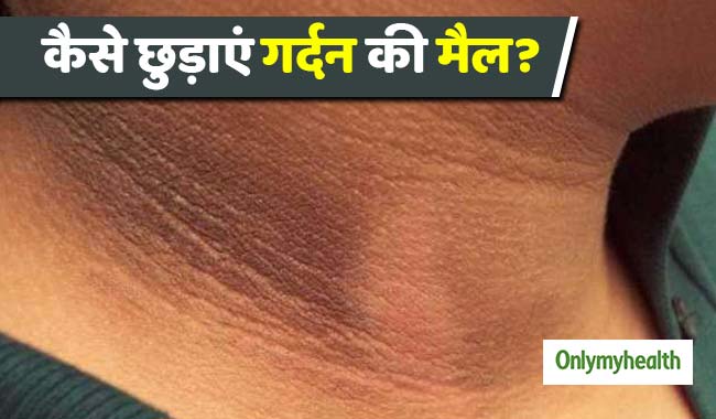 नहाने के बाद गर्दन पर करें इन 5 औषधियों की मालिश, दूर हो जाएगा कालापन  