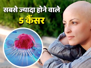 ये 5 कैंसर बढ़ रहे हैं सबसे ज्यादा, जानें इनके बारे में