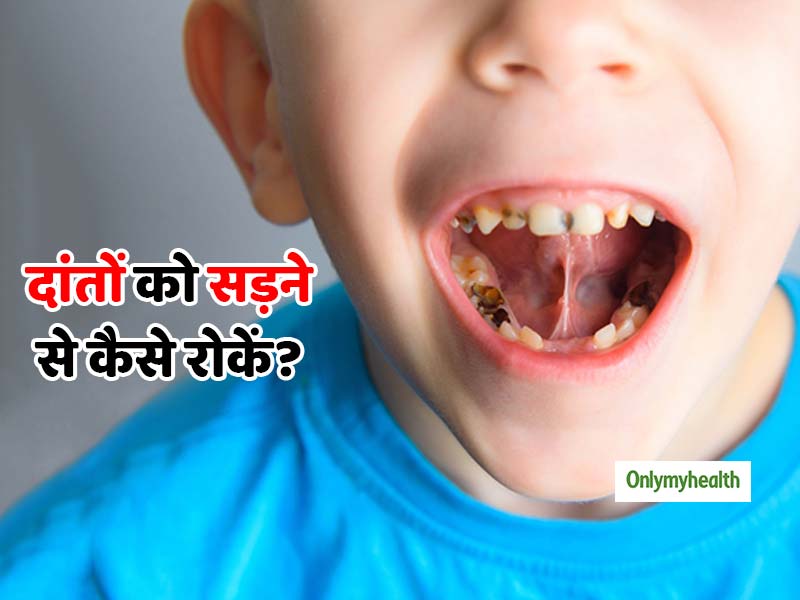 बच्‍चों के दांतों को सड़ने से बचाने के लिए अपनाएं ये 4 आसान उपाय, दांत हमेशा रहेंगे मजबूत   
