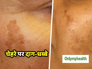 उम्र बढ़ने के साथ चेहरे पर आने वाले दाग-धब्बों यानी 'एज स्पॉट्स' को कैसे छुपाएं?