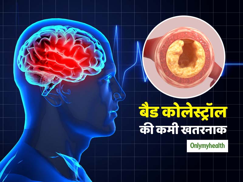 शरीर में 'बैड कोलेस्ट्रॉल' की कमी भी है खतरनाक, स्ट्रोक का बढ़ता है खतरा: रिसर्च