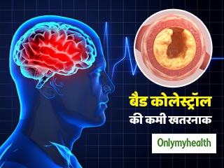 शरीर में 'बैड कोलेस्ट्रॉल' की कमी भी है खतरनाक, स्ट्रोक का बढ़ता है खतरा: रिसर्च