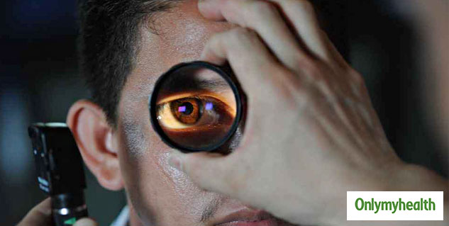 food for eye