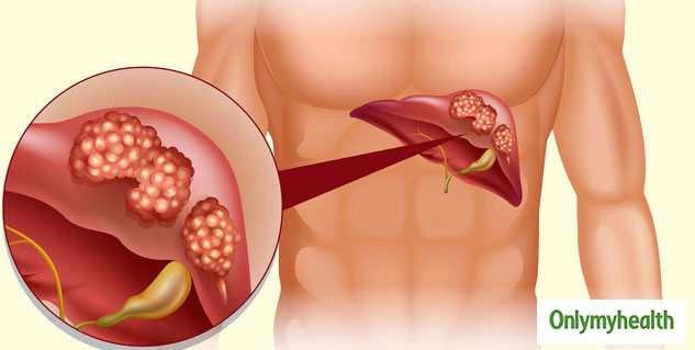 inside_liver_cancer
