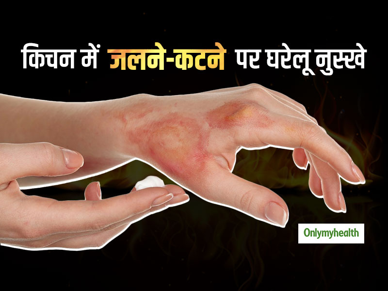 किचन में गलती से जलने, कटने, छिलने जैसी 5 समस्याओं में काम आएंगे ये घरेलू उपाय, मिलेगा तुरंत आराम