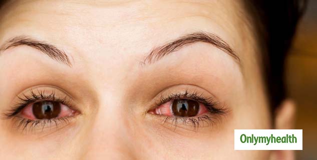 eye-care