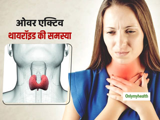 ये 6 लक्षण बताते हैं कि ओवर-एक्टिव हो गया है आपका थायरॉइड, जानें क्या है हायपरथायरॉइडिज्म