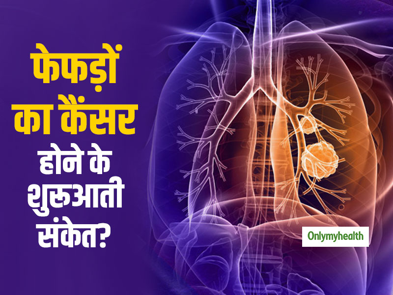 World Lung Cancer Day: कैसे जानें कि आपको 'फेफड़ों का कैंसर' है या नहीं: पढ़ें श्‍वसन रोग विशेषज्ञ की सलाह