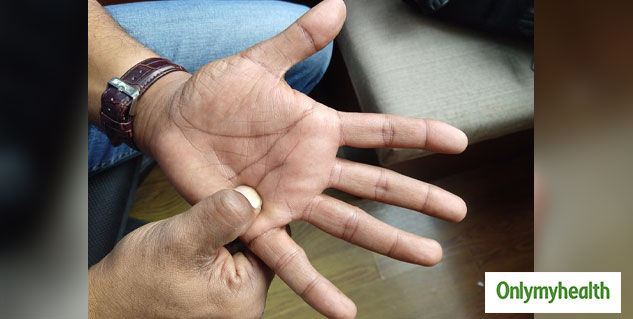 accupressure Point 1