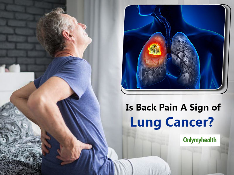 What Is The Correlation Between Back Pain and Lung Cancer? | OnlyMyHealth