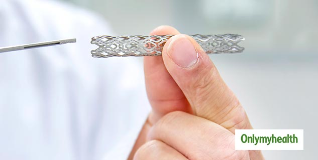 Stent And Bypass Surgery 