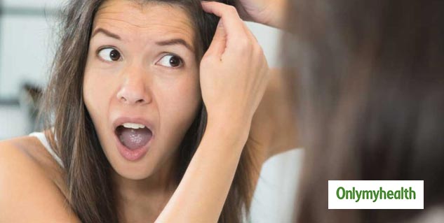hair loss