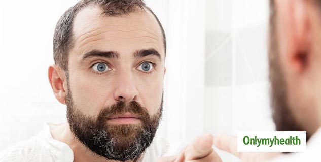 hair loss