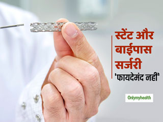 हार्ट अटैक के मरीजों के लिए क्यों फायदेमंद नहीं स्टेंट और बाईपास सर्जरी, जानें शोधर्ताओं की राय