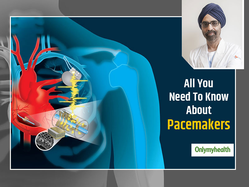 Living With A Pacemaker: Dr Balbir On The Important Checklist For Those With A Pacemaker