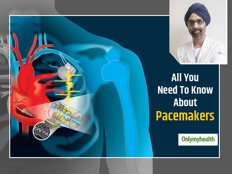 Living With A Pacemaker: Dr Balbir On The Important Checklist For Those ...