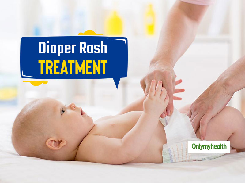 Newborn Care Week 2019: 8 Home Remedies For Severe Diaper Rash 