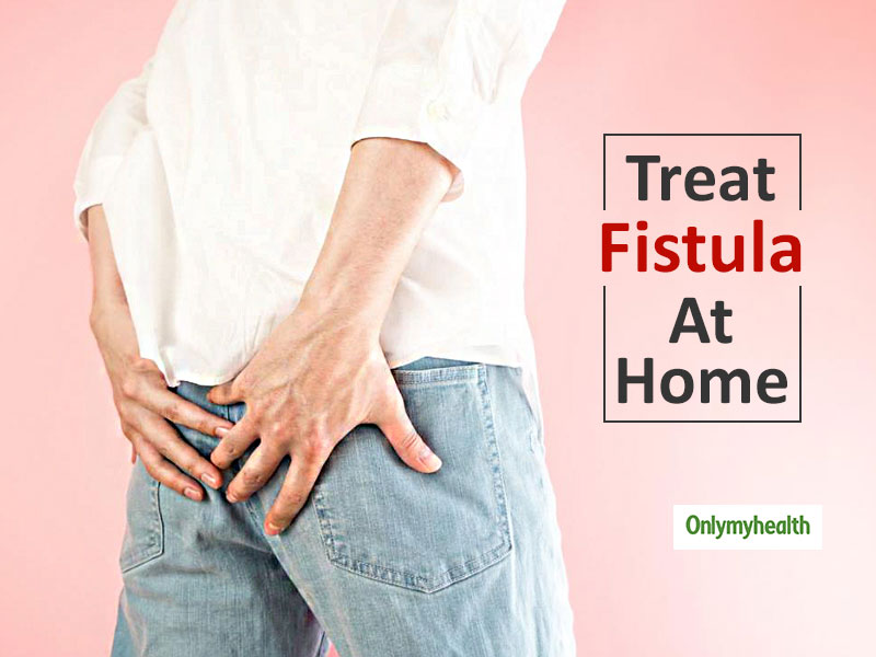 How To Prevent Fistula