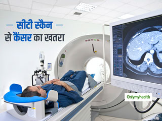 सीटी स्कैन (CT Scan) का रेडिएशन बना सकता है आपको कैंसर का शिकार, वैज्ञानिकों ने अध्ययन के बाद किया दावा
