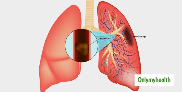 lungs