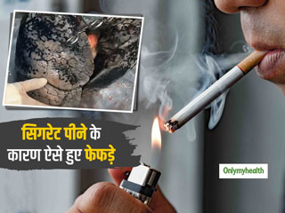 रोज 1 डिब्बी सिगरेट पीने वाले शख्स के फेफड़ों का वीडियो हुआ वायरल, डॉक्टर भी देखकर हुए हैरान