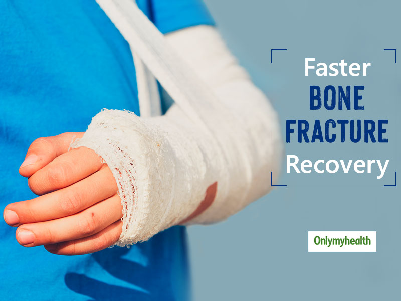 5 Diet Rules To Follow To Make Your Bone Fracture Heal Faster ...