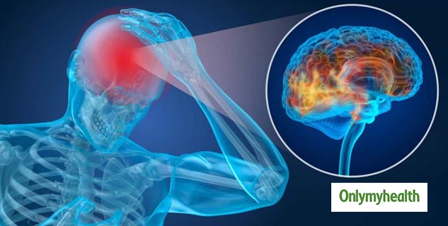 Concussion injury