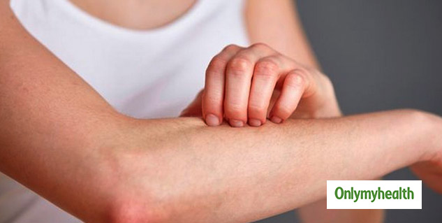 Skin Rashes