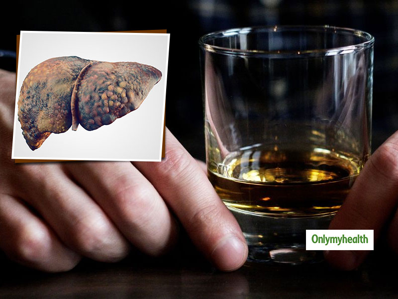 Liver Disease: एल्कोहॉल रिलेटेड लिवर डिजीज के हैं  8 लक्षण और संकेत, जानें बचाव का तरीका 