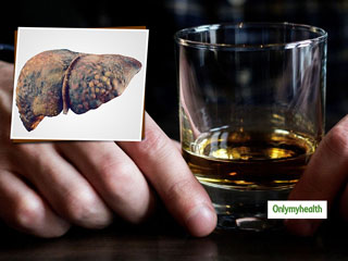 Liver Disease: एल्कोहॉल रिलेटेड लिवर डिजीज के हैं  8 लक्षण और संकेत, जानें बचाव का तरीका 