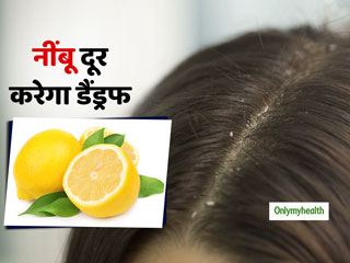 नींबू को इन 3 तरह के इस्तेमाल से चुटकियों में पाएं डैंड्रफ (रूसी) और रूखे बालों से छुटकारा