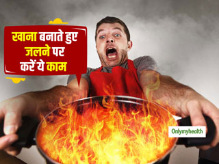 First aid for burns: खाना बनाते हुए या दूध उबालते हुए जलने पर  करें ये 1 काम, दर्द और जलन होगी दूर 