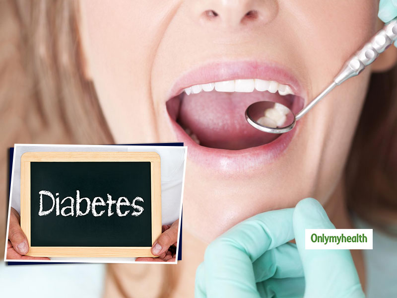 For Simple Tips ... Oral Problems: Type Diabetes 2 Health 5