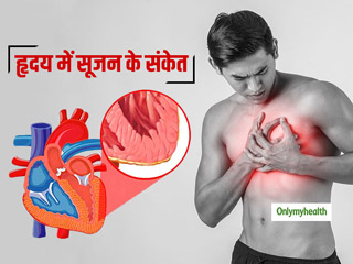 हृदय की मांसपेशियों में सूजन से भी हो सकता है हार्ट फेल, एक्‍सपर्ट से जानें इसके कारण और इलाज
