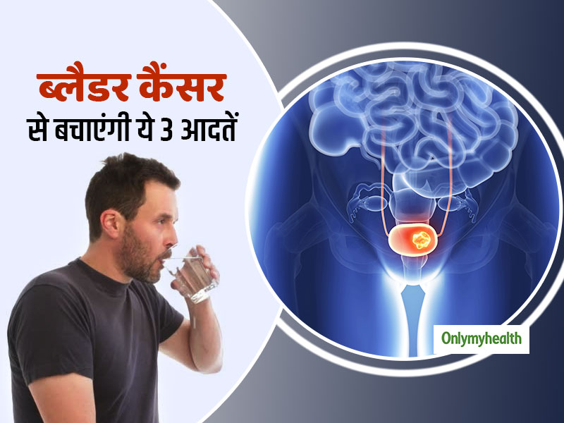 ब्लैडर कैंसर (मूत्राशय के कैंसर) से बचना है तो आज से अपनाएं ये 3 आदतें, जानें किन्हें होता है खतरा