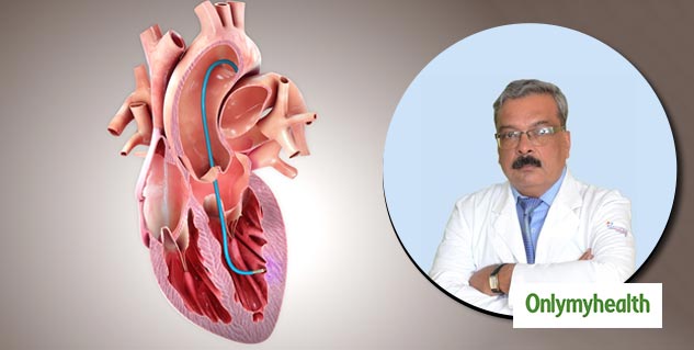 Heart-Bypass-Surgery-In-hindi